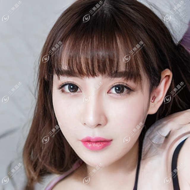 成都温江维普眼科揭秘：近视激光&白内障手术&全飞秒价格一览，性价比之选！