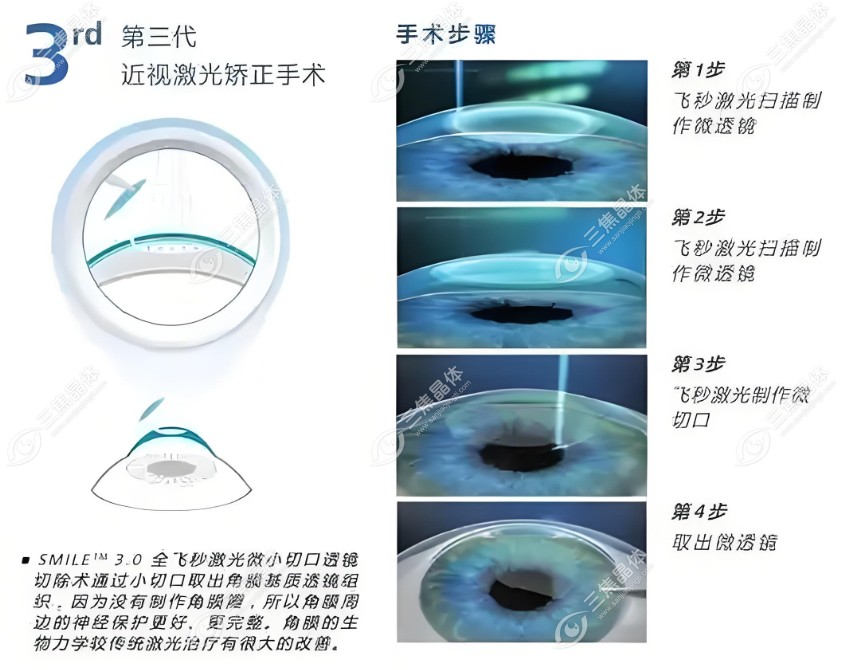 河北邢台眼科近视眼医生排名