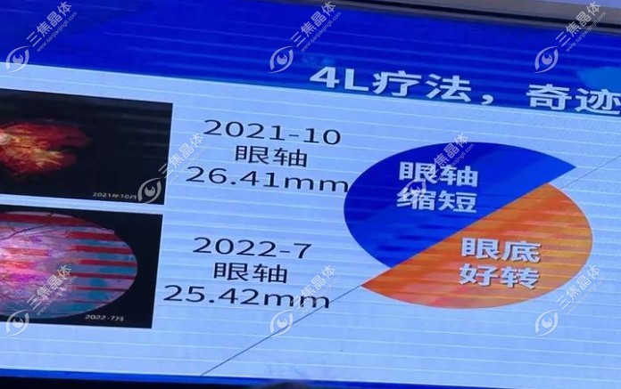 亲测赵阳4l疗法