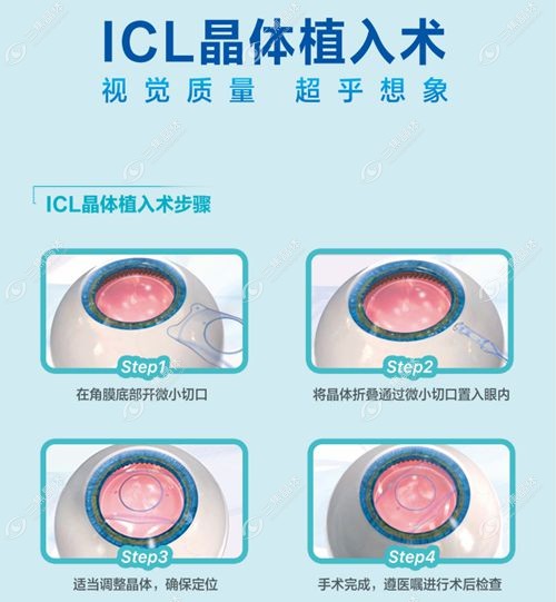 昆明红会医院眼科的四大医生档案