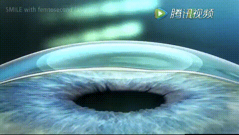 出名的眼科医院全飞秒