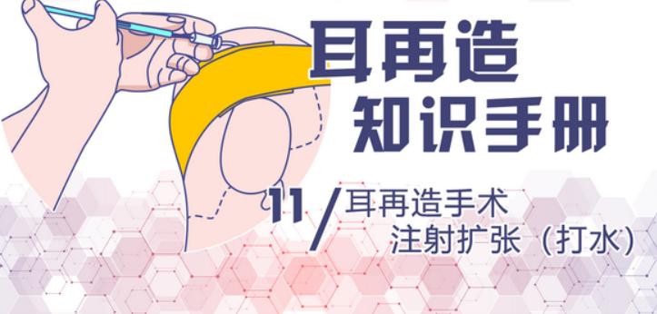 三、舒铂支架与传统材料的全面对比分析