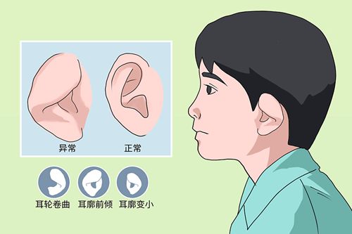 四、安波耳再造常见问题解答