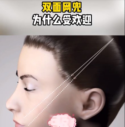 纯干货!刘暾医生拉皮手术怎么预约?2026年官方渠道预约步骤全公开-亲测抢号难度与术后自然度避坑指南