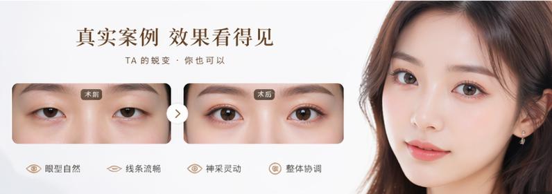 一、南充双眼皮价格表2026年全解析：从1280元到上万元，钱花在哪了？